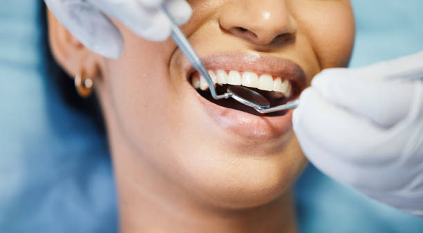 Best Emergency Dental Services for Seniors in Sacramento, CA